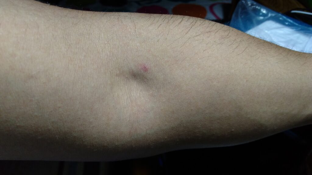 Review Donating Plasma Emmanuel Contreras